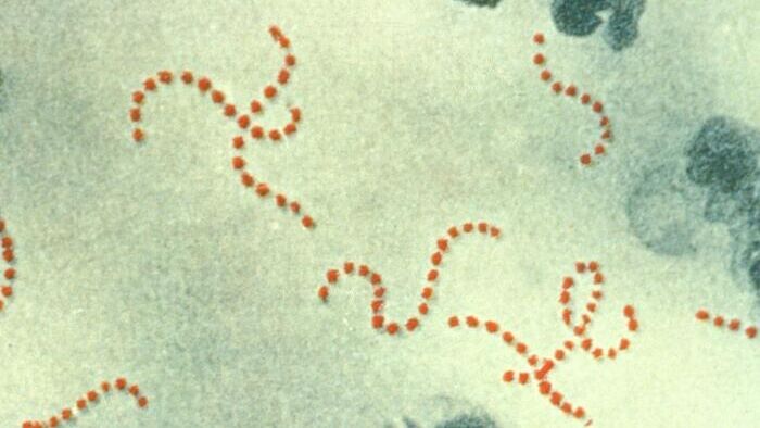 Streptococcus pyogenes под микроскопом - РИА Новости, 1920, 07.10.2020