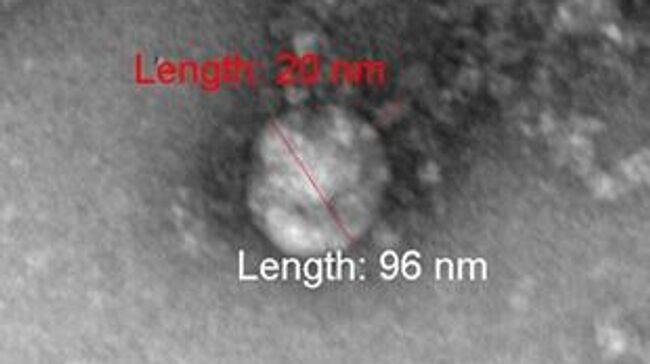 Фотография под микроскопом британского штамма коронавируса