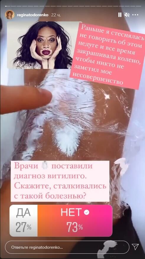 Скриншот Instagram-stories Регины Тодоренко (@reginatodorenko) - РИА Новости, 1920, 18.03.2021