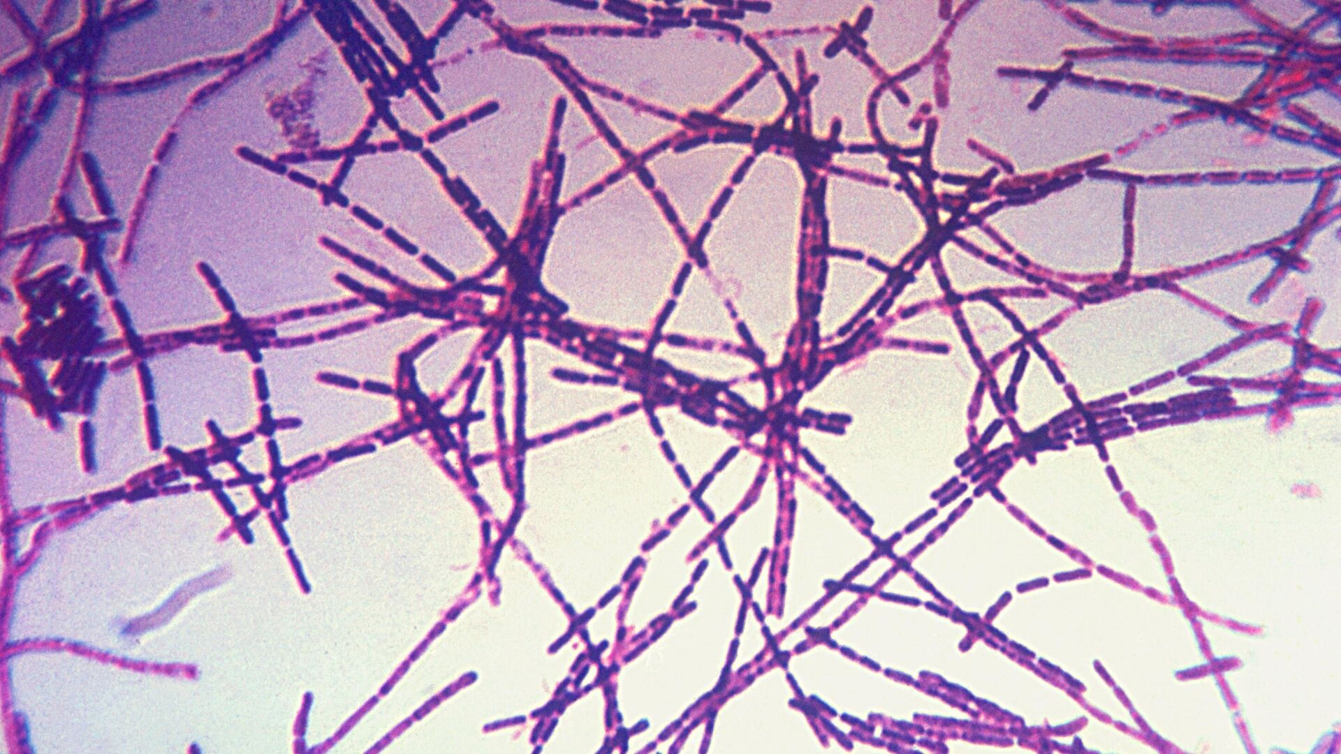 Микрофотография бацилл сибирской язвы - РИА Новости, 1920, 21.08.2023