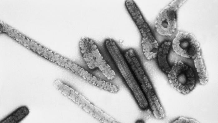 Вирус Марбург под электронным микроскопом - РИА Новости, 1920, 16.02.2023