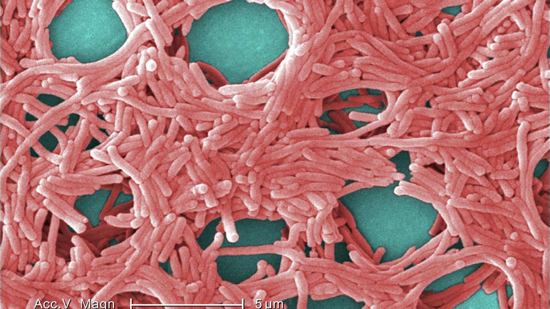 Бактерия Legionella pneumophila под электронным микроскопом - РИА Новости, 1920, 01.09.2023