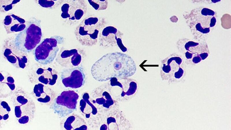 Naegleria fowleri - РИА Новости, 1920, 05.07.2024