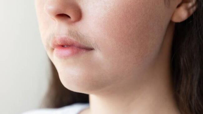 усатая девочка