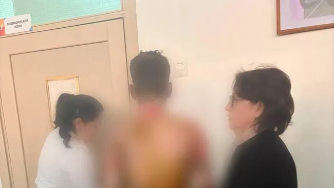 Пострадавший ученик при нападении в школе Красноярска