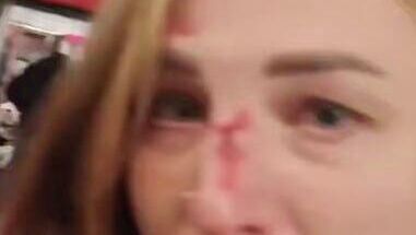 Пострадавшая при нападении в московском метро - РИА Новости, 1920, 09.02.2026