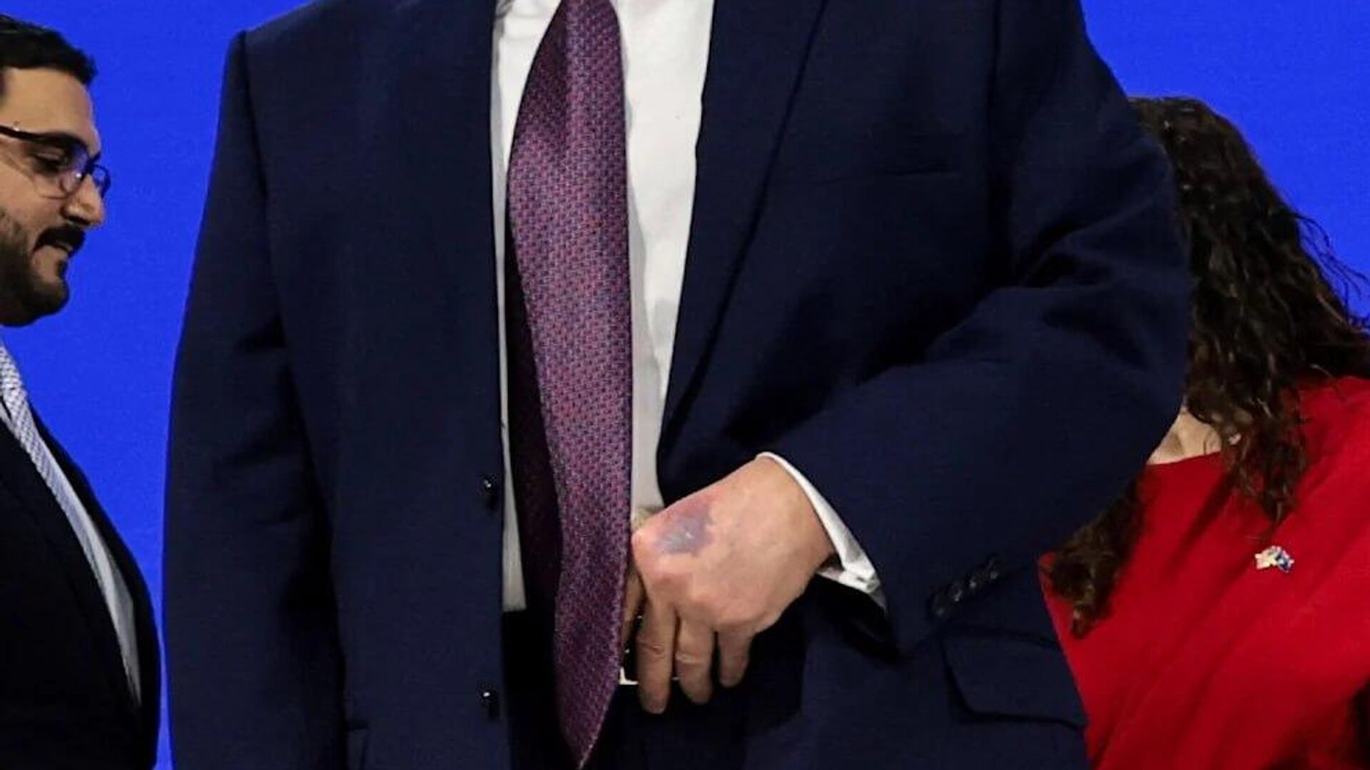 Трамп с кровоподтеком на руке - РИА Новости, 1920, 04.03.2026