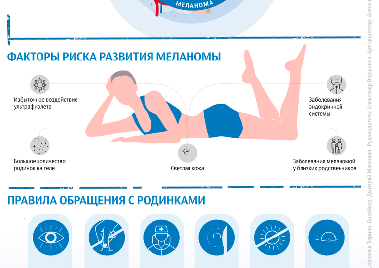 Родинка или меланома?