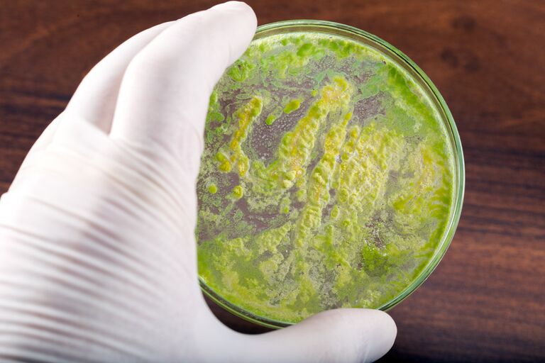 Чашка Петри с бактериями Чашка Петри с бактериями