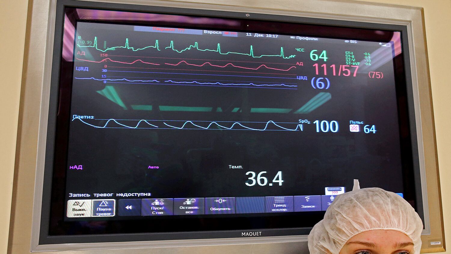 Дисплей с показателями состояния оперируемого больного - РИА Новости, 1920, 22.09.2022