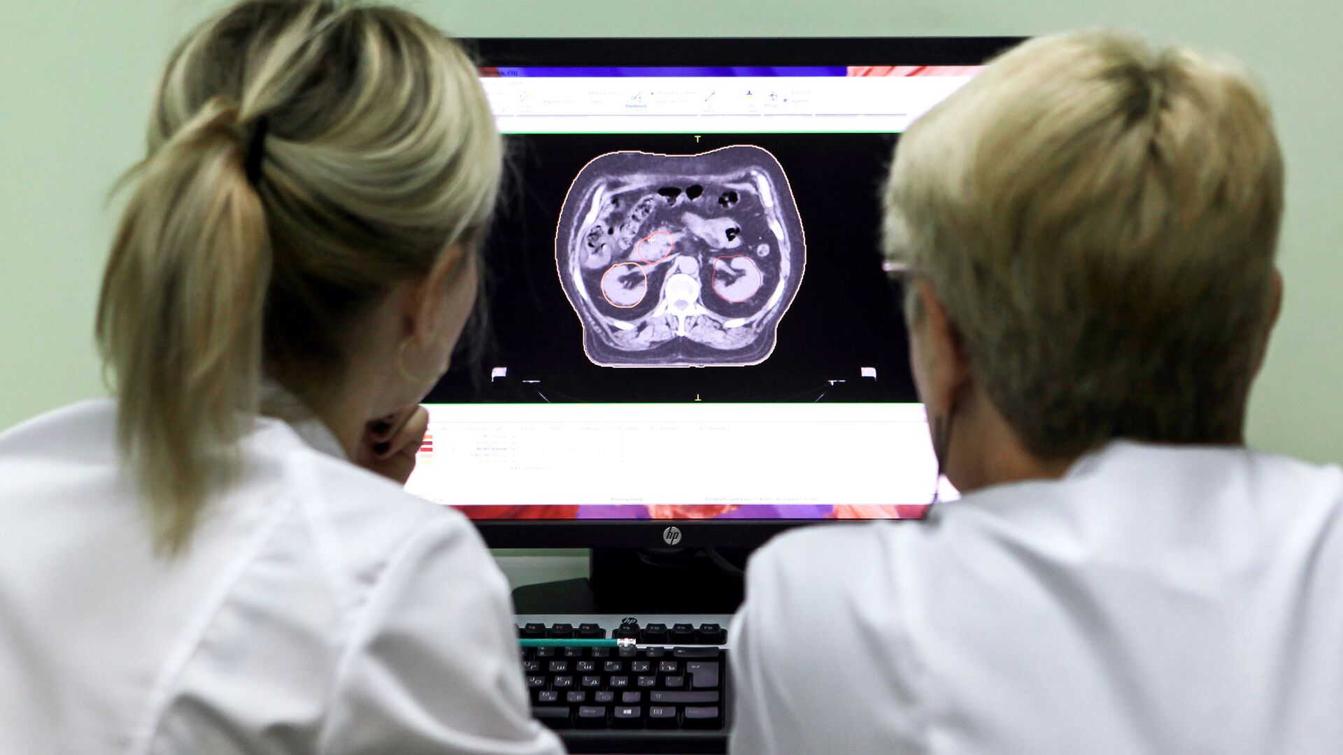 Симуляция плана лучевого лечения в онкологическом диспансере - РИА Новости, 1920, 29.09.2025