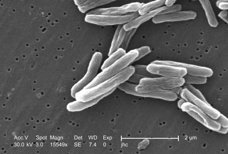 Возбудитель туберкулеза - бактерия Mycobacterium tuberculosis