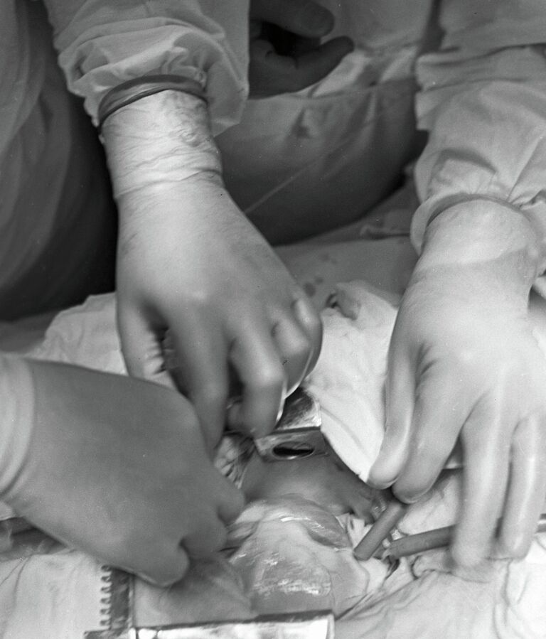 Операция на сердце